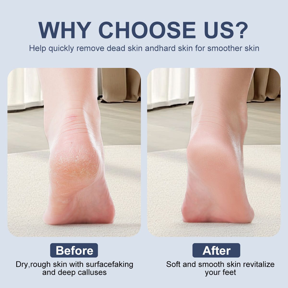 New Electric Callus Remover For Feet, Portable Rechargeable Foot Repair And Grinding Device With Digital Display, Heel Polisher File For Men Women Dry Callus Dead Skin